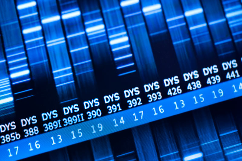 View of a genetic research sample analysis.